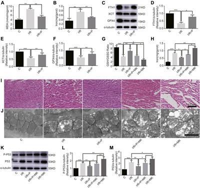 Propofol Protects Myocardium From Ischemia/Reperfusion Injury by Inhibiting Ferroptosis Through the AKT/p53 Signaling Pathway